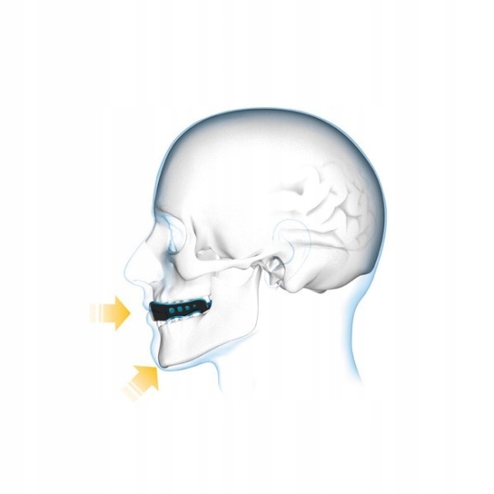 Ochraniacz na zęby Shock Doctor gel max